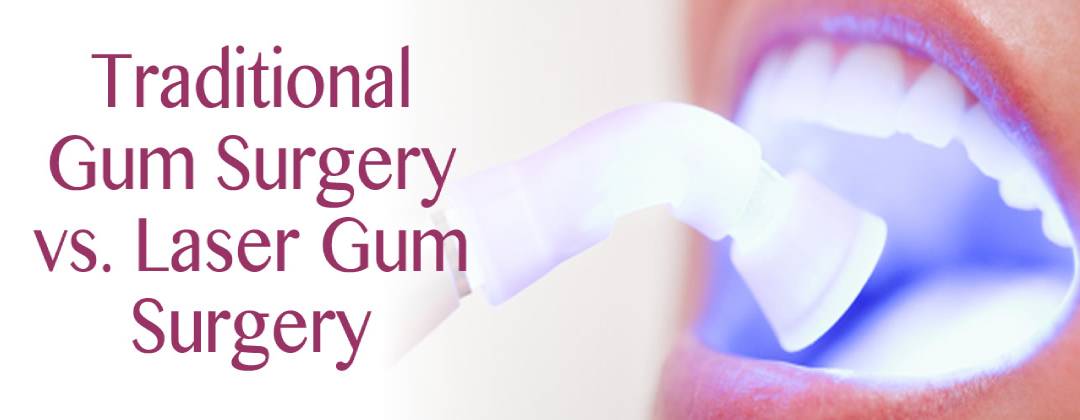 Traditional Gum Surgery vs. Laser Gum Surgery
