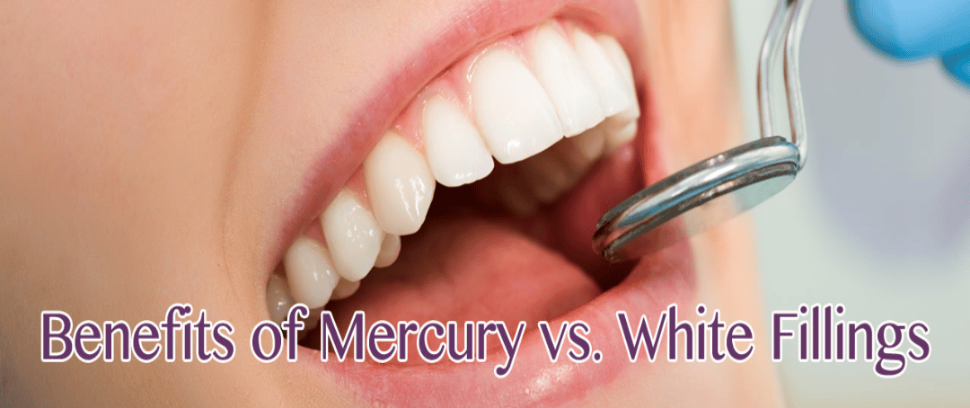 Benefits of Mercury vs. White Fillings