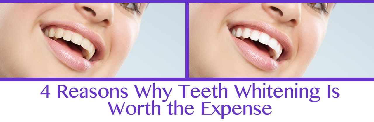 Teeth Whitening in Newtonville MA Is Worth the Expense