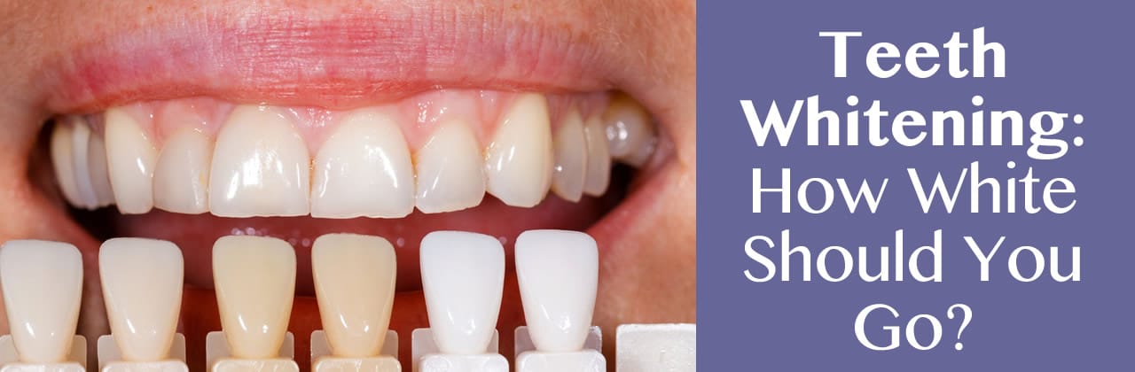 Teeth Whitening In Newton MA: How White Should You Go?