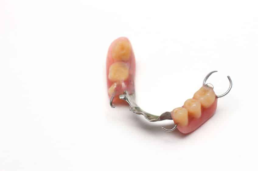 Dental Brdge