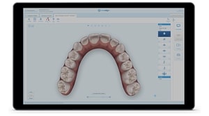 Invisalign