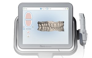 Invisalign (braces alternatives)