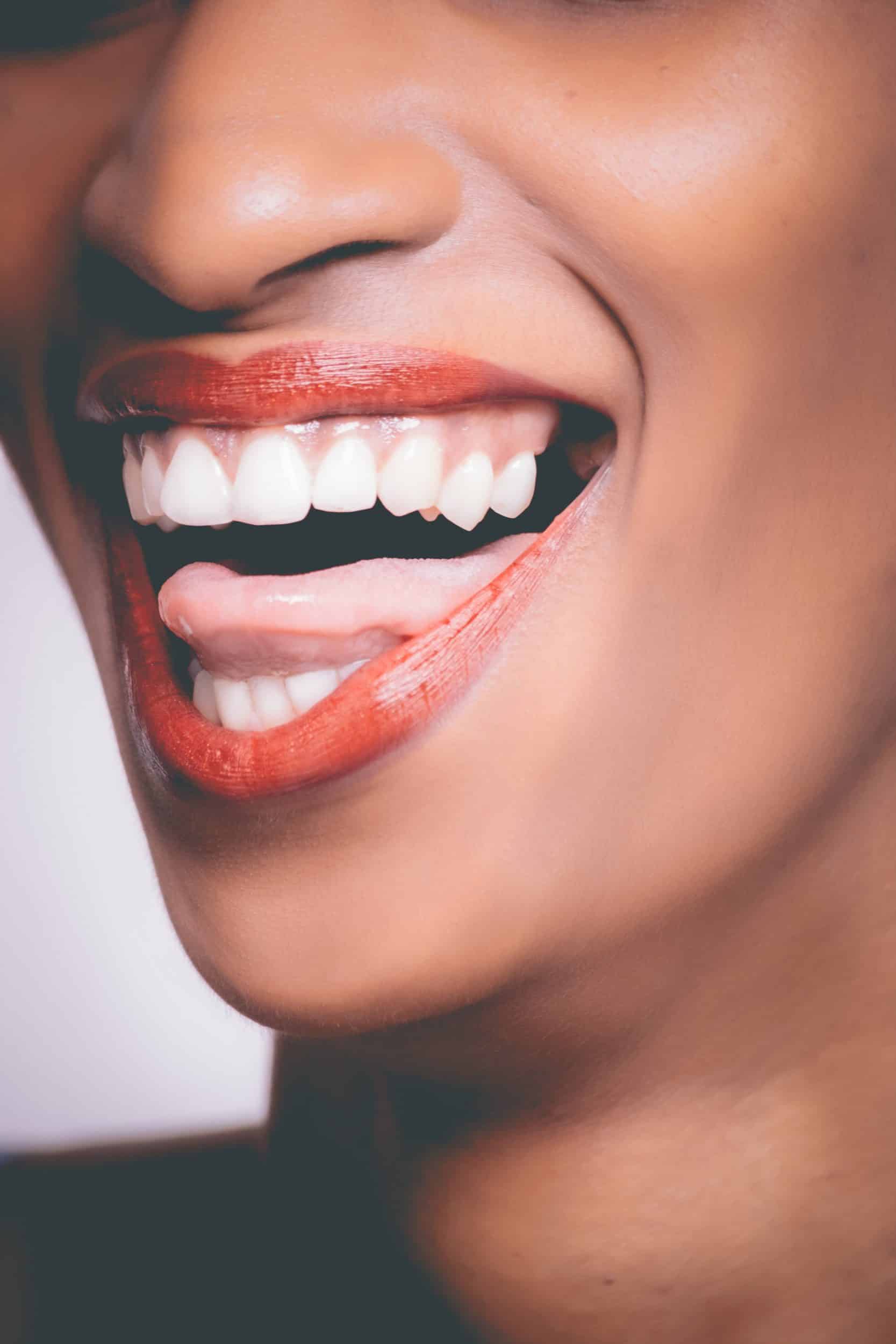 Cosmetic Bonding Brighton MA