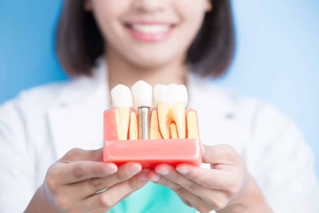 woman dentist take implant tooth