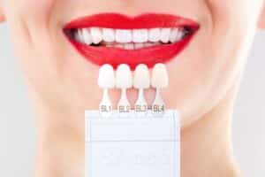 Close up of a woman’s smile being matched to the perfect veneers to match her teeth.