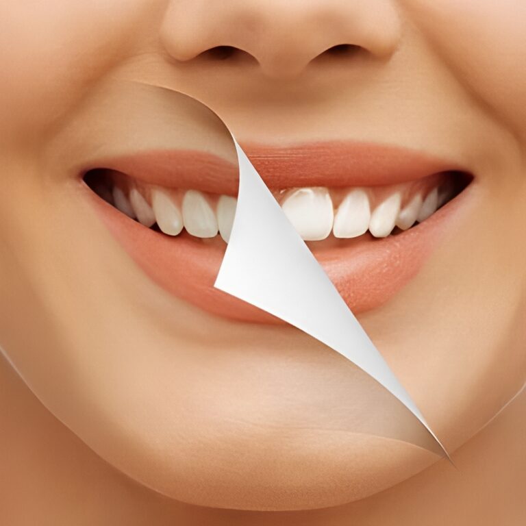 zoom whitening