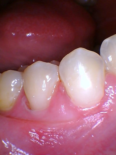 After Image: Bonding - front